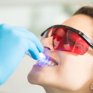 Closeup of young woman having her teeth whitened with ultraviolet light in a dental clinic